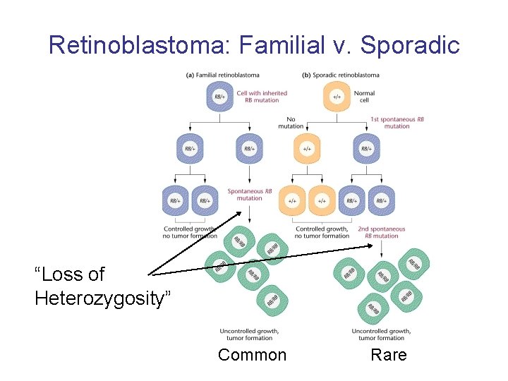 Retinoblastoma: Familial v. Sporadic “Loss of Heterozygosity” Common Rare 