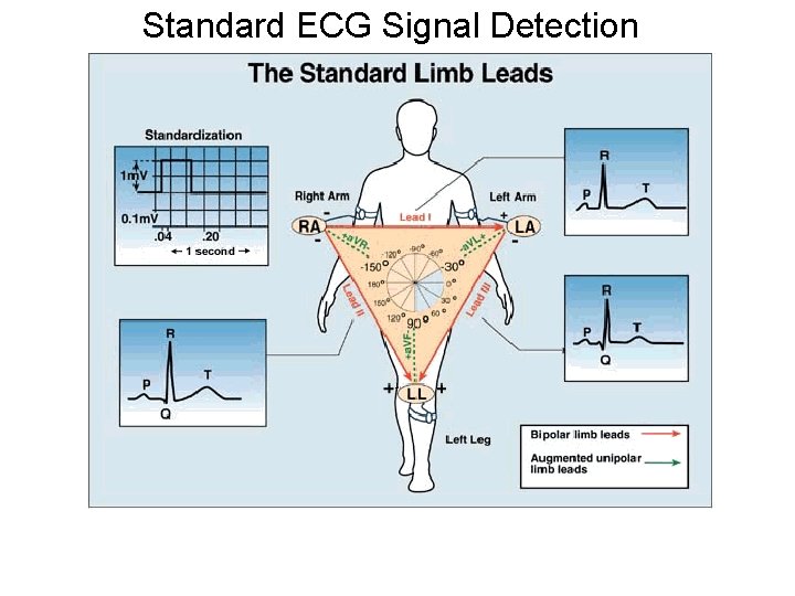 Standard ECG Signal Detection 