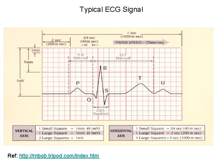 Typical ECG Signal Ref: http: //rnbob. tripod. com/index. htm 