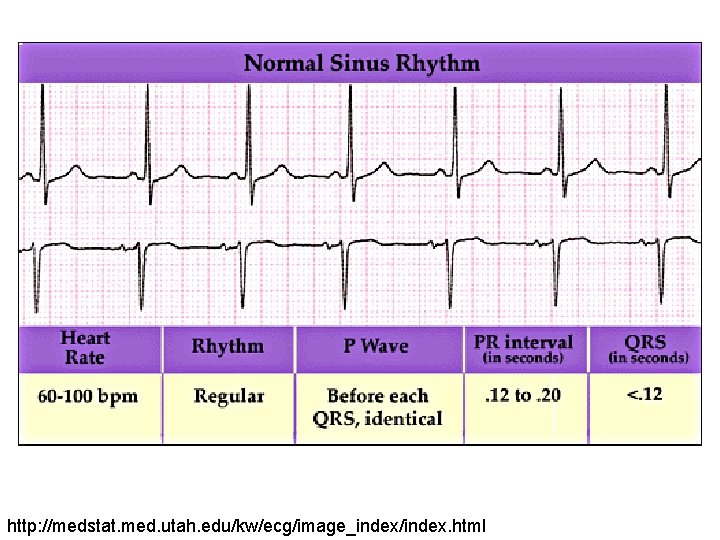 http: //medstat. med. utah. edu/kw/ecg/image_index/index. html 