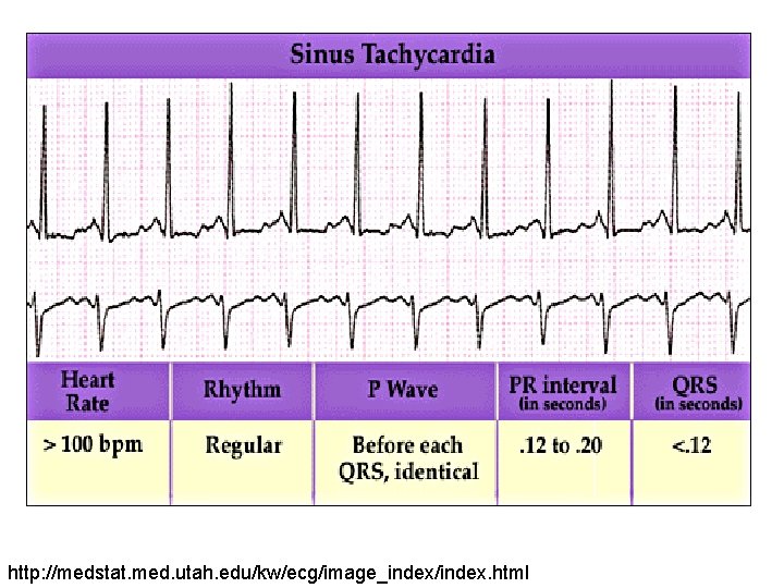 http: //medstat. med. utah. edu/kw/ecg/image_index/index. html 