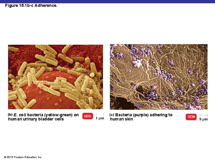 Figure 15. 1 b-c Adherence. E. coli bacteria (yellow-green) on human urinary bladder cells