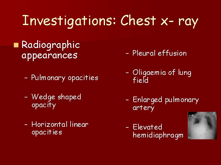 Investigations: Chest x- ray n Radiographic appearances – Pleural effusion – Pulmonary opacities –