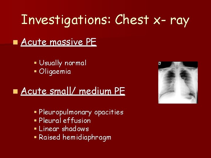 Investigations: Chest x- ray n Acute massive PE § Usually normal § Oligaemia n