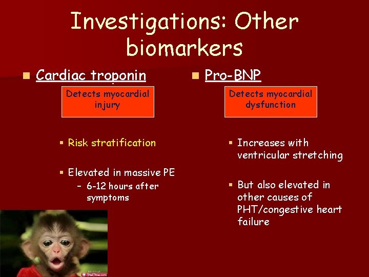 Investigations: Other biomarkers n Cardiac troponin Detects myocardial injury § Risk stratification § Elevated