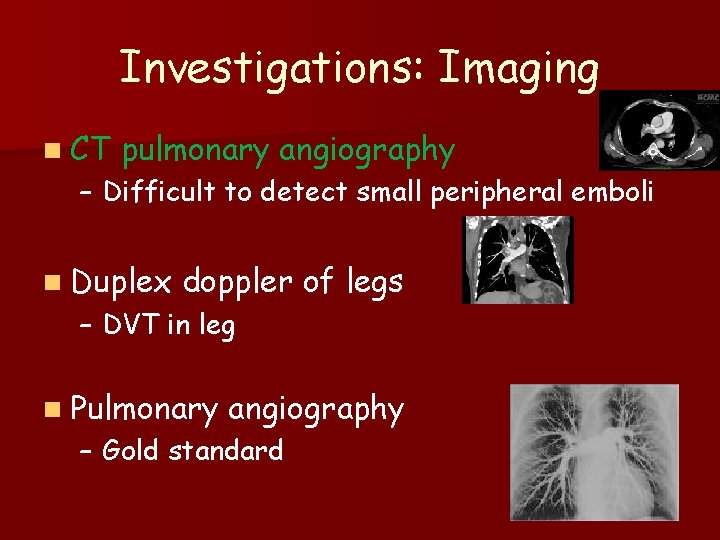 Investigations: Imaging n CT pulmonary angiography – Difficult to detect small peripheral emboli n