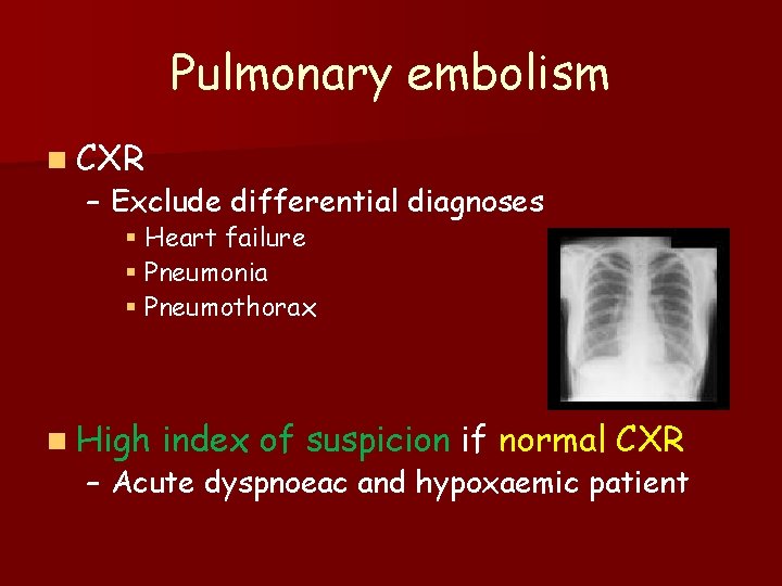 Pulmonary embolism n CXR – Exclude differential diagnoses § Heart failure § Pneumonia §