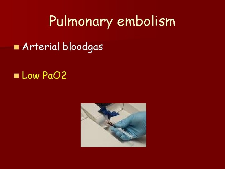 Pulmonary embolism n Arterial n Low bloodgas Pa. O 2 