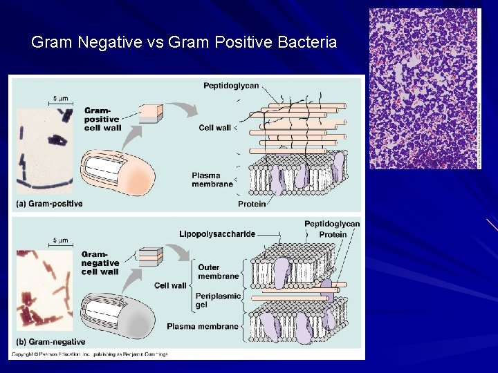 Gram Negative vs Gram Positive Bacteria 