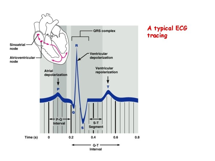 A typical ECG tracing 