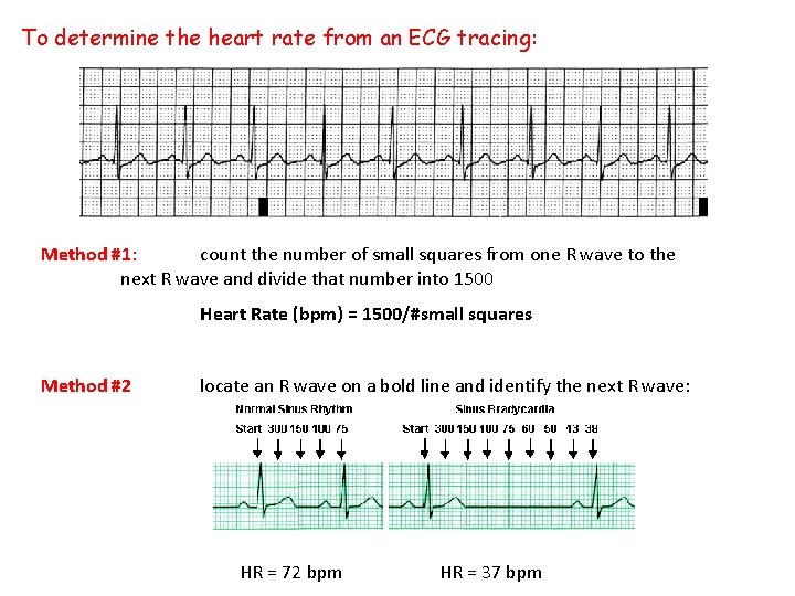 To determine the heart rate from an ECG tracing: Method #1: count the number