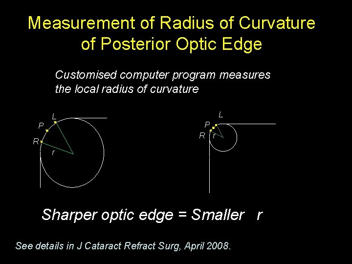 Measurement of Radius of Curvature of Posterior Optic Edge Customised computer program measures the