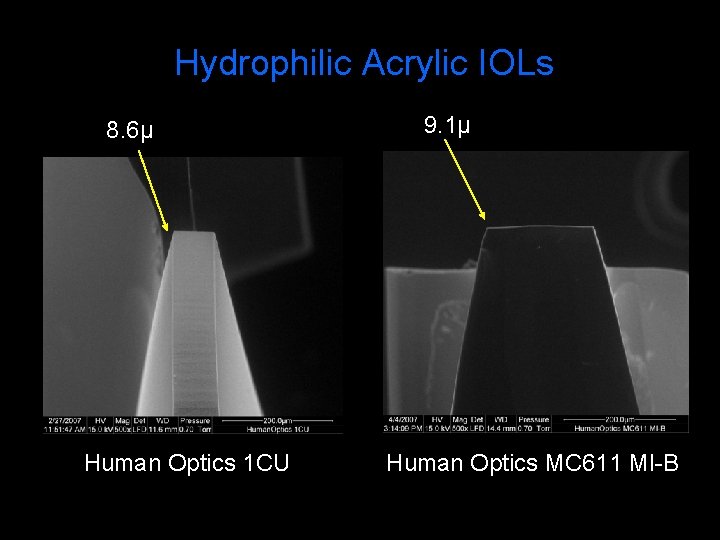 Hydrophilic Acrylic IOLs 8. 6µ Human Optics 1 CU 9. 1µ Human Optics MC