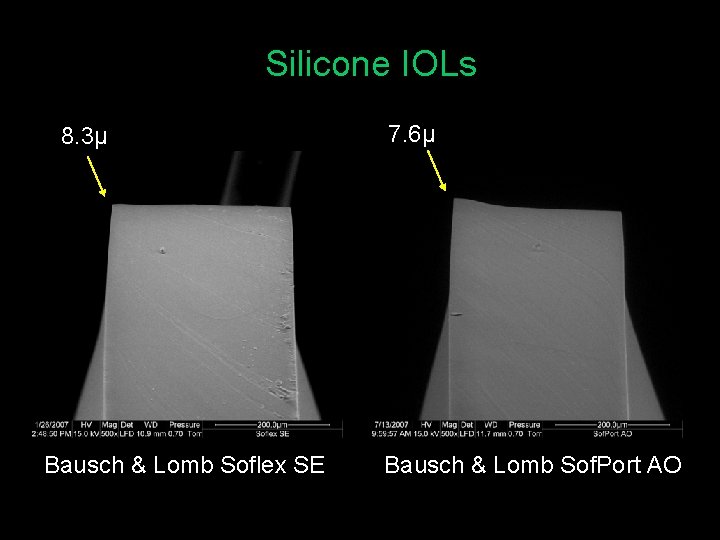 Silicone IOLs 8. 3µ Bausch & Lomb Soflex SE 7. 6µ Bausch & Lomb