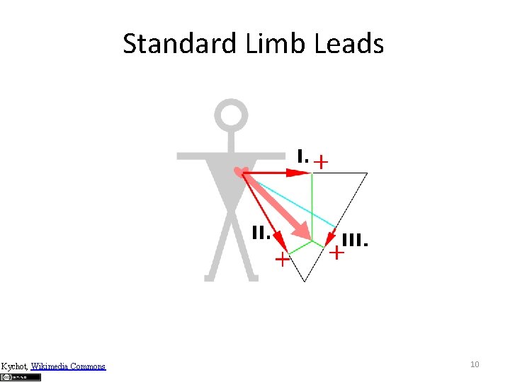 Standard Limb Leads Kychot, Wikimedia Commons 10 