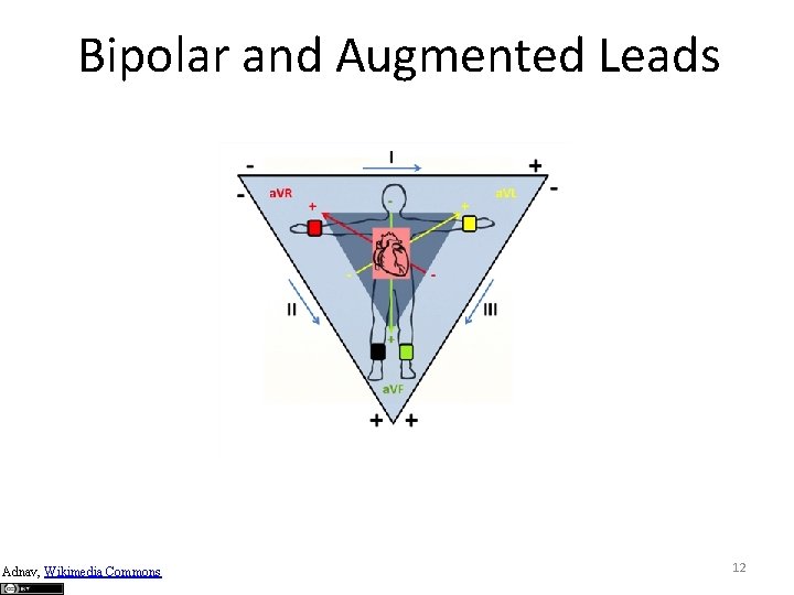 Bipolar and Augmented Leads Adnav, Wikimedia Commons 12 