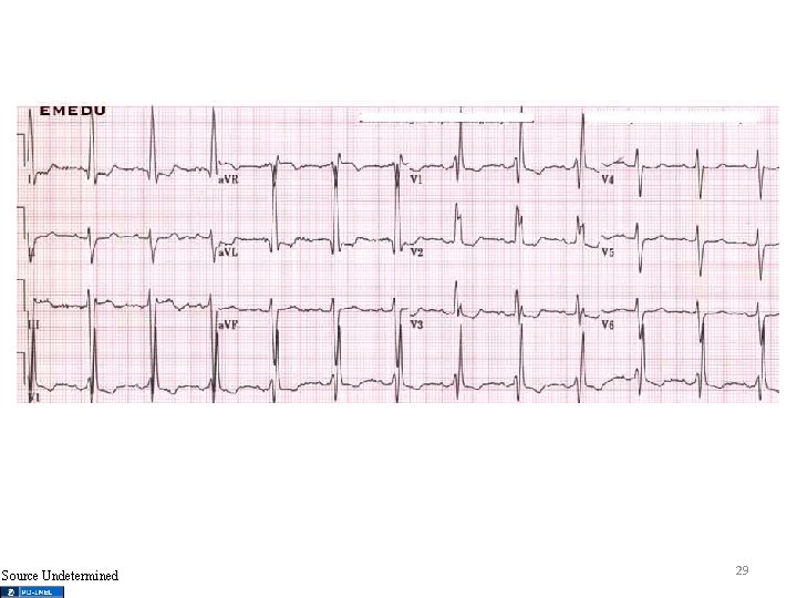 Source Undetermined 29 