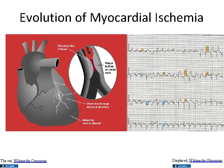 Evolution of Myocardial Ischemia The cat, Wikimedia Commons 32 Displaced, Wikimedia Commons 