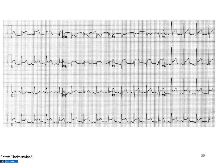 Source Undetermined 39 