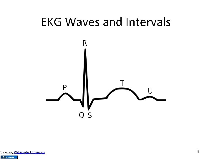 EKG Waves and Intervals Skvalen, Wikimedia Commons 5 