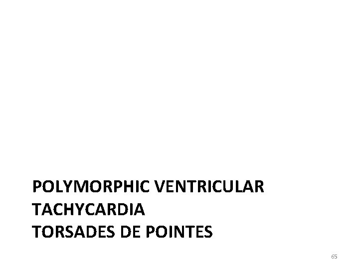 POLYMORPHIC VENTRICULAR TACHYCARDIA TORSADES DE POINTES 65 