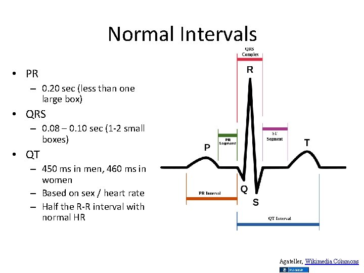 Normal Intervals • PR – 0. 20 sec (less than one large box) •
