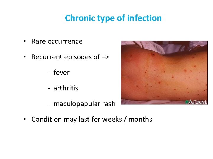 Chronic type of infection • Rare occurrence • Recurrent episodes of –> - fever