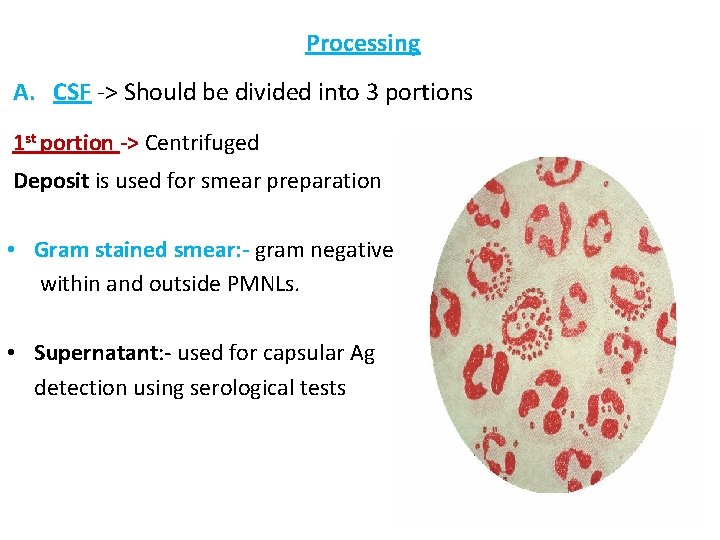 Processing A. CSF -> Should be divided into 3 portions 1 st portion ->