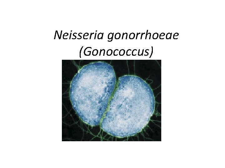 Neisseria gonorrhoeae (Gonococcus) 