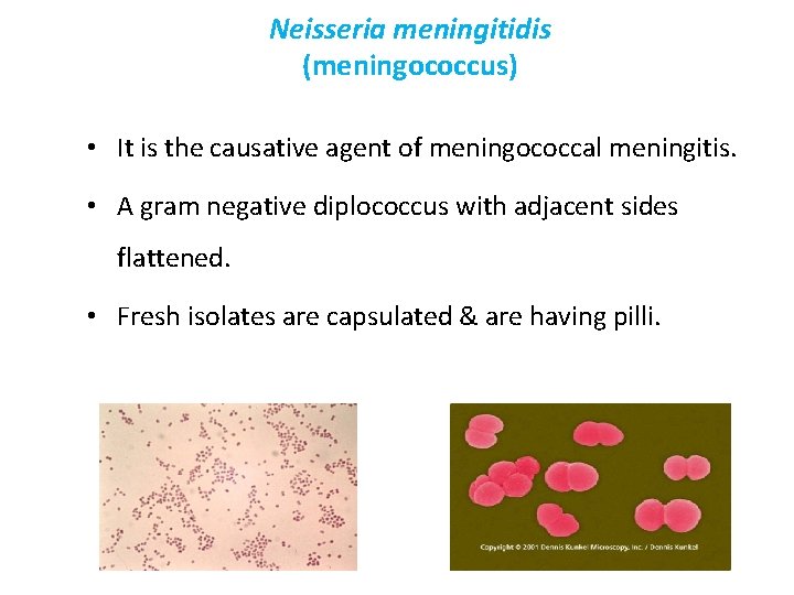 Neisseria meningitidis (meningococcus) • It is the causative agent of meningococcal meningitis. • A
