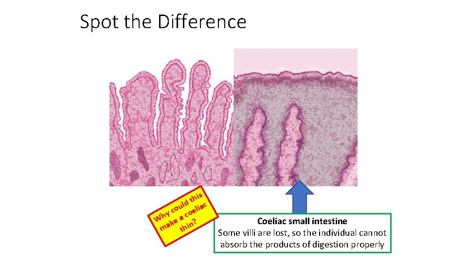 Spot the Difference his t ld ou oeliac c y c Wh ke a