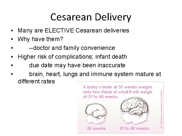 Cesarean Delivery • Many are ELECTIVE Cesarean deliveries • Why have them? • --doctor