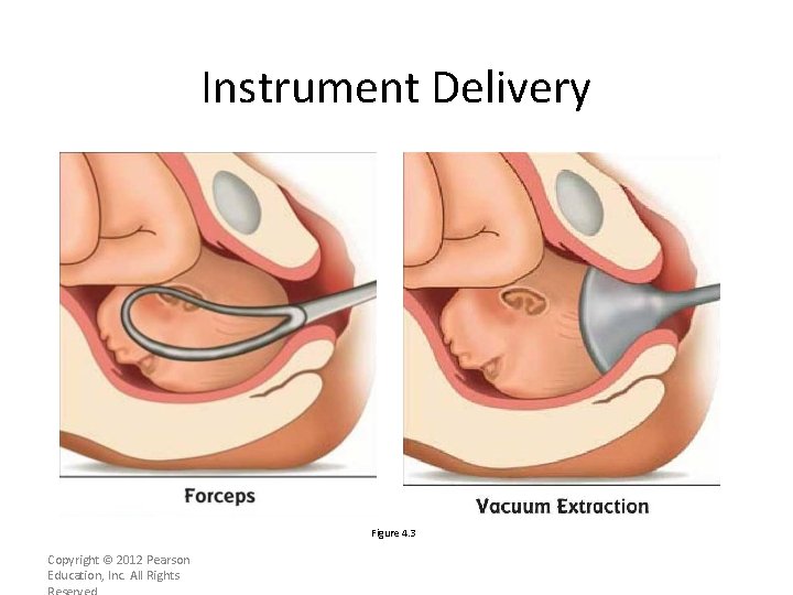 Instrument Delivery Figure 4. 3 Copyright © 2012 Pearson Education, Inc. All Rights 