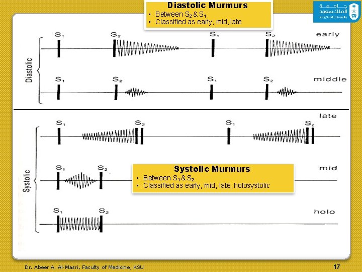 Diastolic Murmurs • Between S 2 & S 1 • Classified as early, mid,