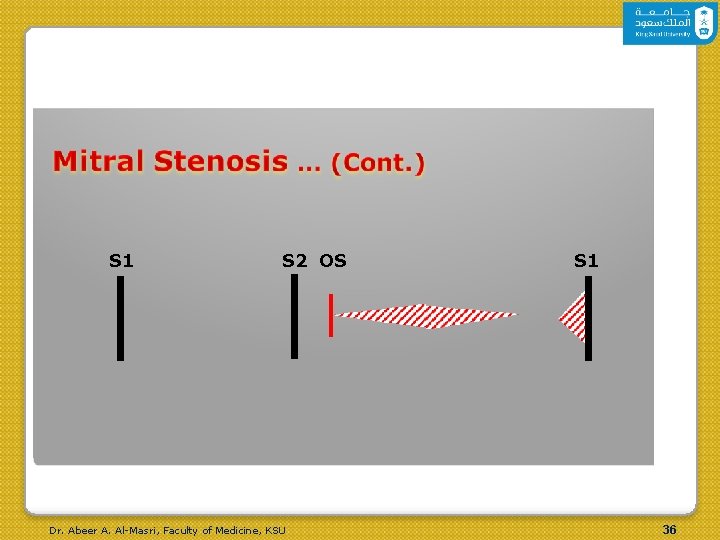 S 1 S 2 OS Dr. Abeer A. Al-Masri, Faculty of Medicine, KSU S S 1 S 2 OS Dr. Abeer A. Al-Masri, Faculty of Medicine, KSU S