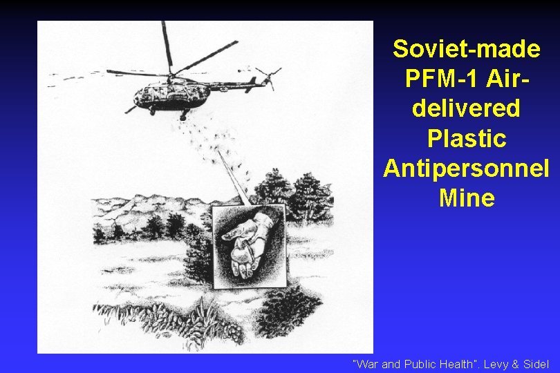Soviet-made PFM-1 Airdelivered Plastic Antipersonnel Mine “War and Public Health”. Levy & Sidel 