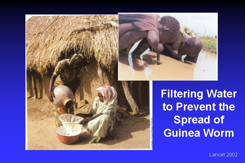 Filtering Water to Prevent the Spread of Guinea Worm Lancet 2002 
