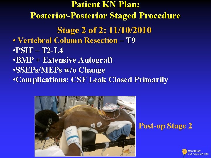 Patient KN Plan: Posterior-Posterior Staged Procedure Stage 2 of 2: 11/10/2010 • Vertebral Column