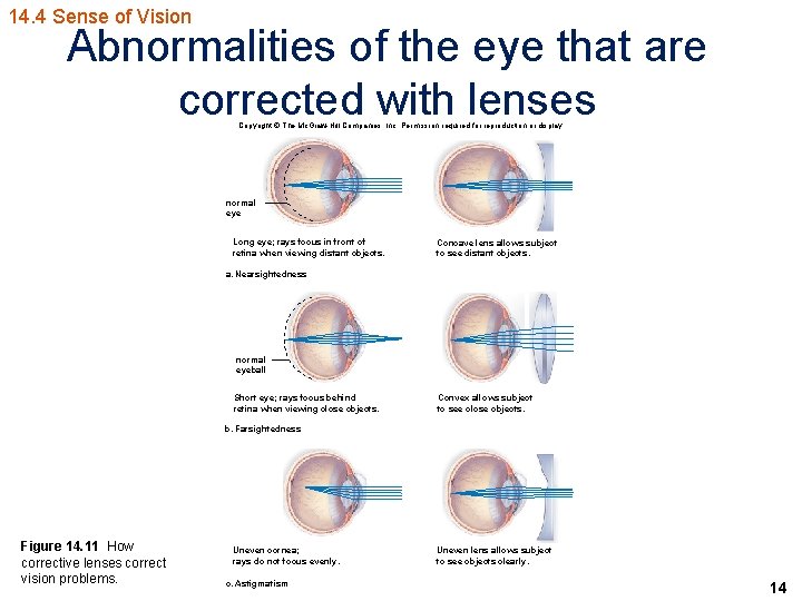 14. 4 Sense of Vision Abnormalities of the eye that are corrected with lenses