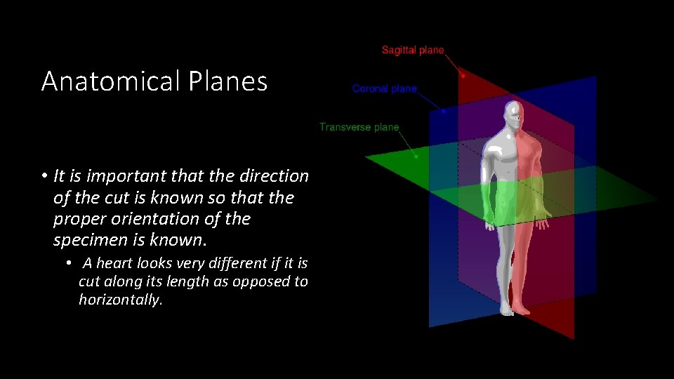 Anatomical Planes • It is important that the direction of the cut is known