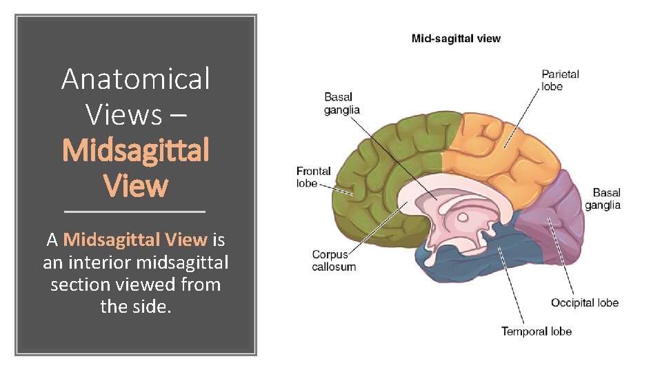 Anatomical Views – Midsagittal View A Midsagittal View is an interior midsagittal section viewed