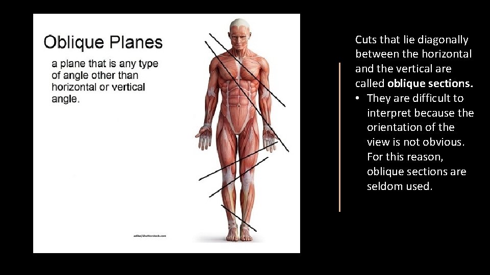 Cuts that lie diagonally between the horizontal and the vertical are called oblique sections.