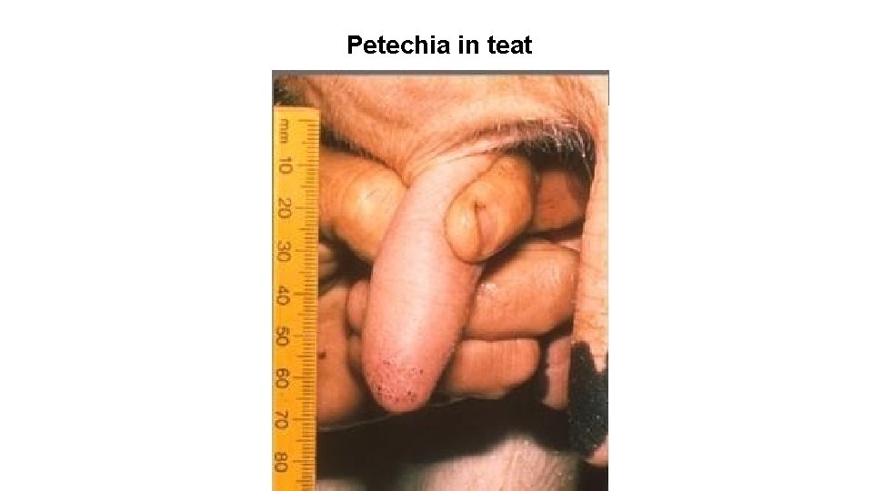 Petechia in teat Petechia in teat