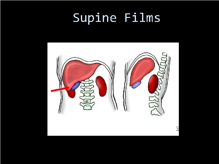 Supine Films 68 