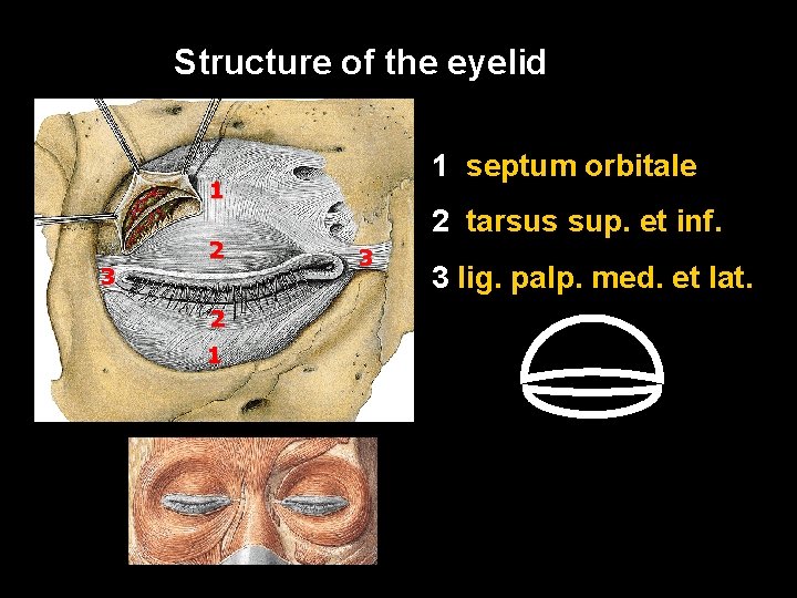 Structure of the eyelid 1 septum orbitale 1 3 2 2 1 2 tarsus Structure of the eyelid 1 septum orbitale 1 3 2 2 1 2 tarsus