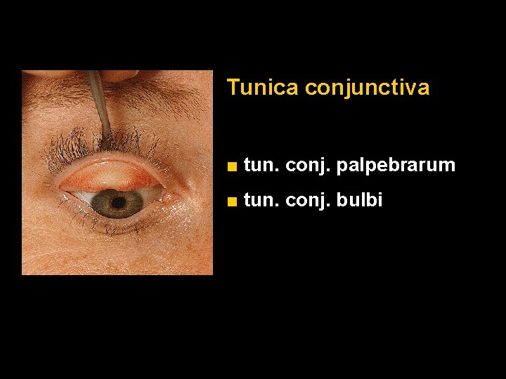Tunica conjunctiva ■ tun. conj. palpebrarum ■ tun. conj. bulbi Tunica conjunctiva ■ tun. conj. palpebrarum ■ tun. conj. bulbi