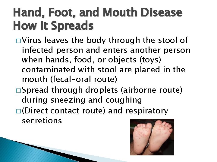 Hand, Foot, and Mouth Disease How it Spreads � Virus leaves the body through