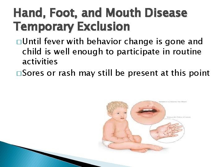 Hand, Foot, and Mouth Disease Temporary Exclusion � Until fever with behavior change is