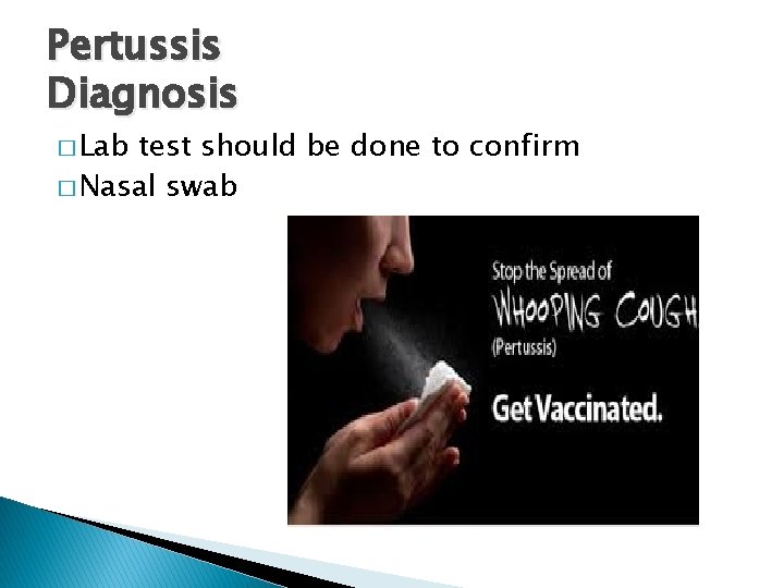 Pertussis Diagnosis � Lab test should be done to confirm � Nasal swab 