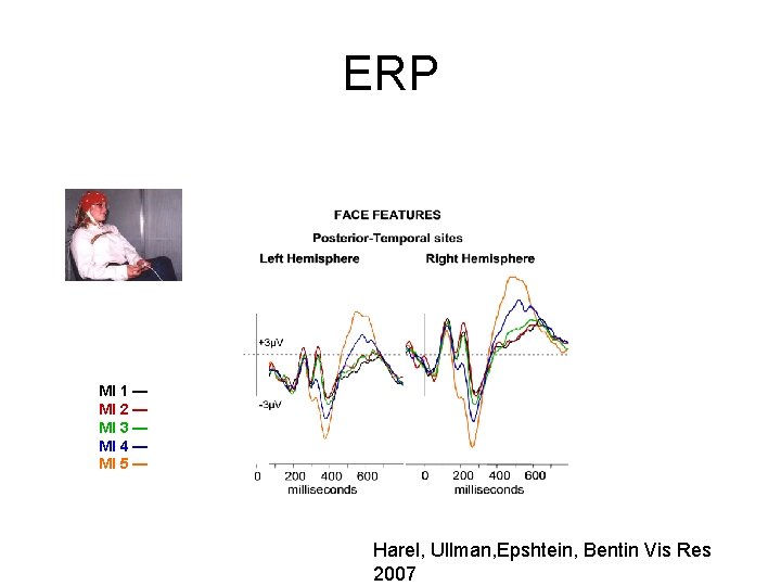 ERP MI 1 — MI 2 — MI 3 — MI 4 — MI ERP MI 1 — MI 2 — MI 3 — MI 4 — MI